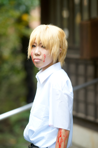 懂球帝比分：滥用妇科洗液导致中度宫颈糜烂